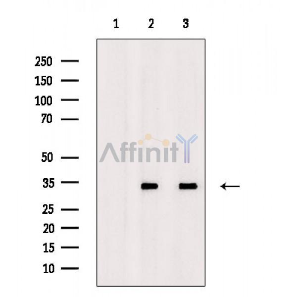ING2 Antibody - Western blot analysis of extracts from various samples, using ING2 Antibody.