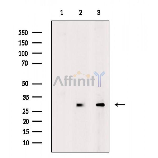 GPR146 Antibody - Western blot analysis of extracts from various samples, using GPR146 Antibody.