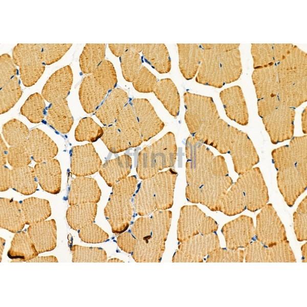 GPR64 Antibody - DF2758 at 1/100 staining Mouse muscle tissue by IHC-P.