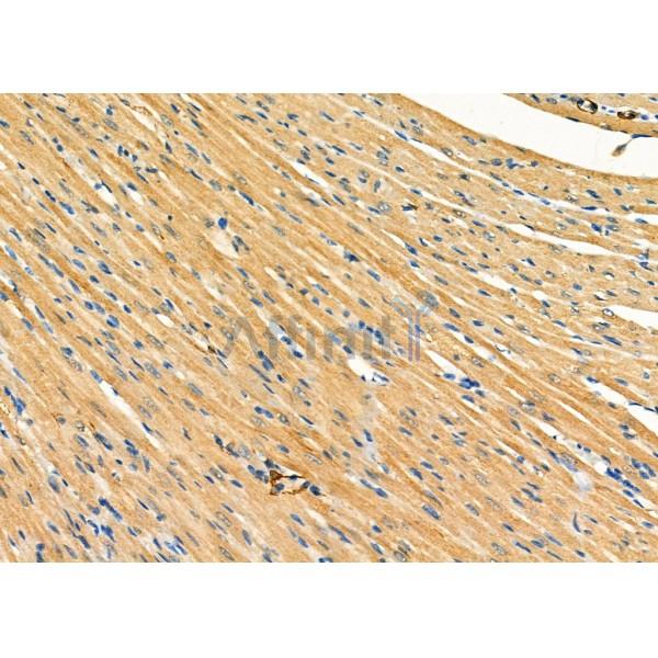 GPR64 Antibody - DF2758 at 1/100 staining Rat heart tissue by IHC-P.