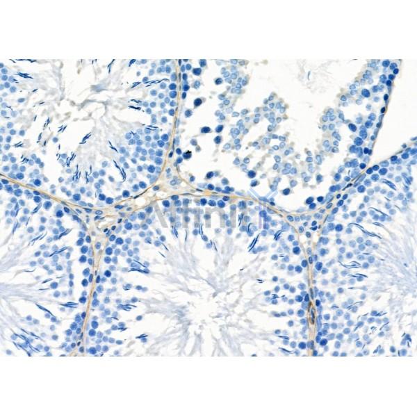 GPR64 Antibody - DF2758 at 1/100 staining Rat testis tissue by IHC-P.