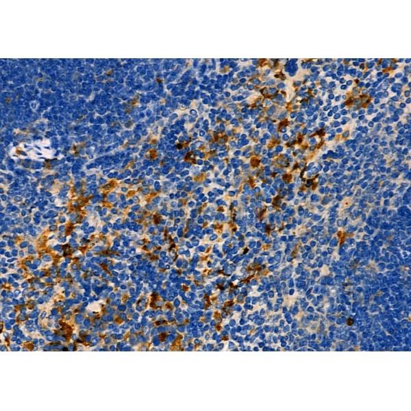 FAKD3 Antibody - DF3281 at 1/100 staining Mouse spleen tissue by IHC-P.
