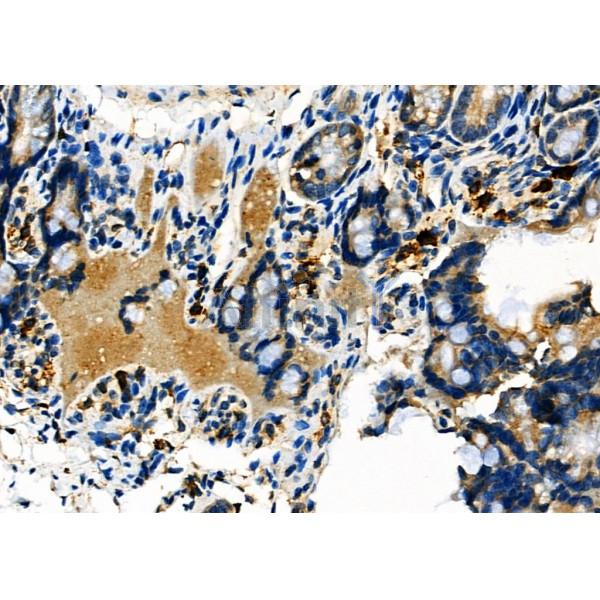 RIN3 Antibody - DF3364 at 1/100 staining Mouse colorectal tissue by IHC-P.