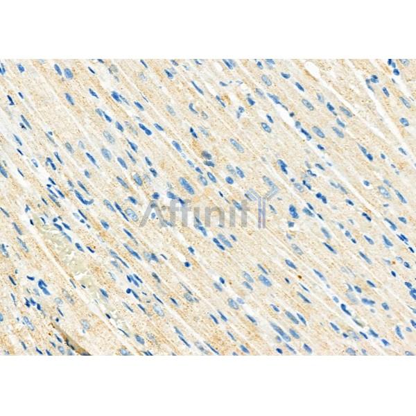 ATP5H Antibody - DF3802 at 1/100 staining Rat heart tissue by IHC-P.