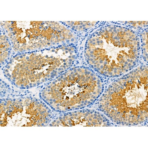 CLIP2 Antibody - DF3877 at 1/100 staining Mouse testis tissue by IHC-P.