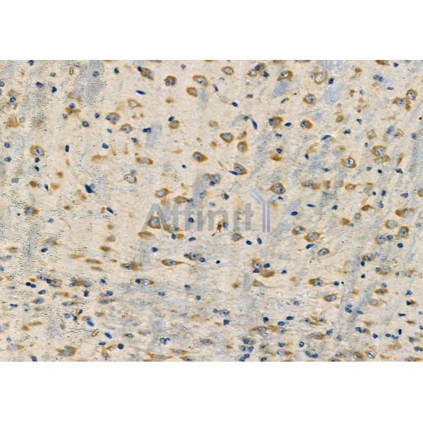 CRABP2 Antibody - DF3914 at 1/100 staining Mouse brain tissue by IHC-P.