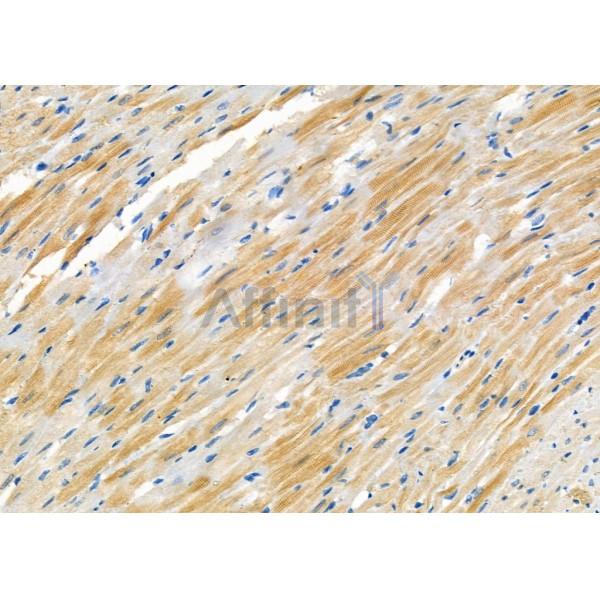 CRABP2 Antibody - DF3914 at 1/100 staining Rat heart tissue by IHC-P.