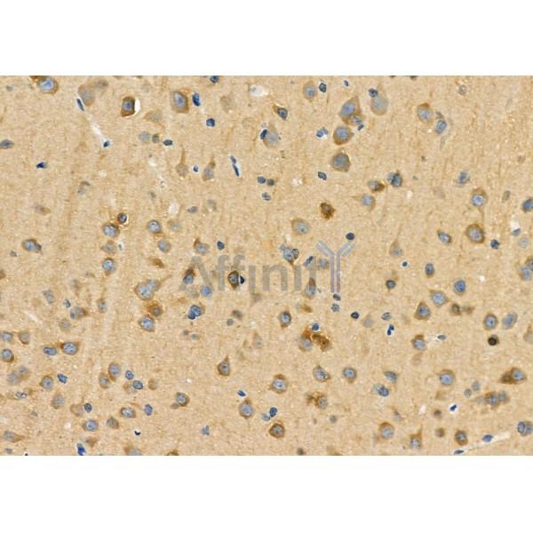 CRABP2 Antibody - DF3914 at 1/100 staining Rat brain tissue by IHC-P.