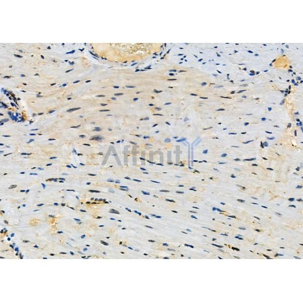 CLCN7 Antibody - DF3932 at 1/100 staining Mouse heart tissue by IHC-P.
