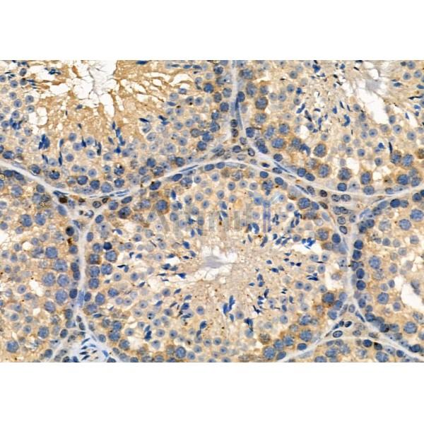 CLCN7 Antibody - DF3932 at 1/100 staining Mouse testis tissue by IHC-P.