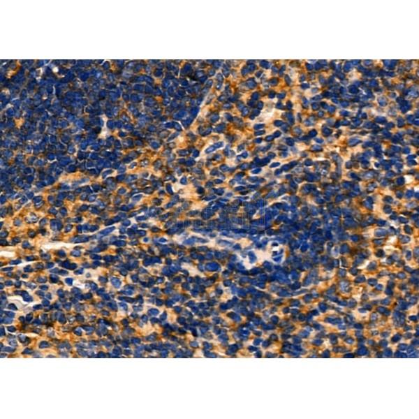 GSDMC Antibody - DF4157 at 1/100 staining Mouse spleen tissue by IHC-P.