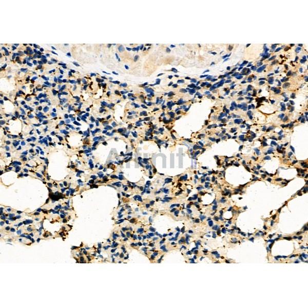 GSDMC Antibody - DF4157 at 1/100 staining Rat lung tissue by IHC-P.
