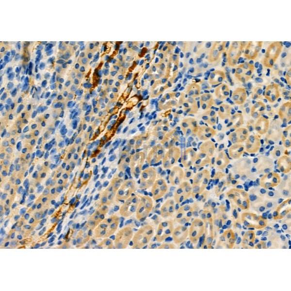 RAB20 Antibody - DF4396 at 1/100 staining Mouse kidney tissue by IHC-P.