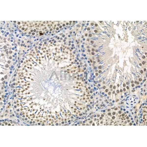USP19 Antibody - DF4589 at 1/100 staining Rat testis tissue by IHC-P.