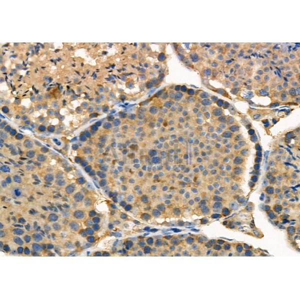 USP45 Antibody - DF4595 at 1/100 staining Mouse testis tissue by IHC-P.
