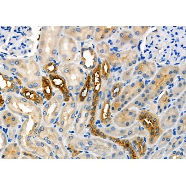 USP45 Antibody - DF4595 at 1/100 staining Rat kidney tissue by IHC-P.
