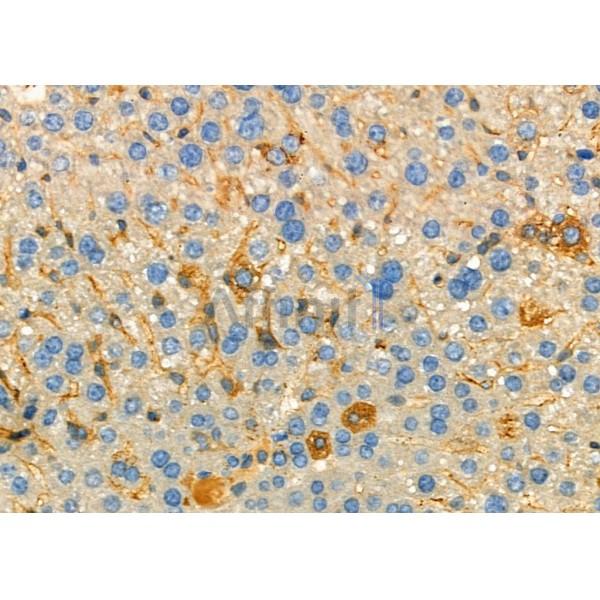 TCL1A Antibody - DF6112 at 1/100 staining Mouse skin tissue by IHC-P.