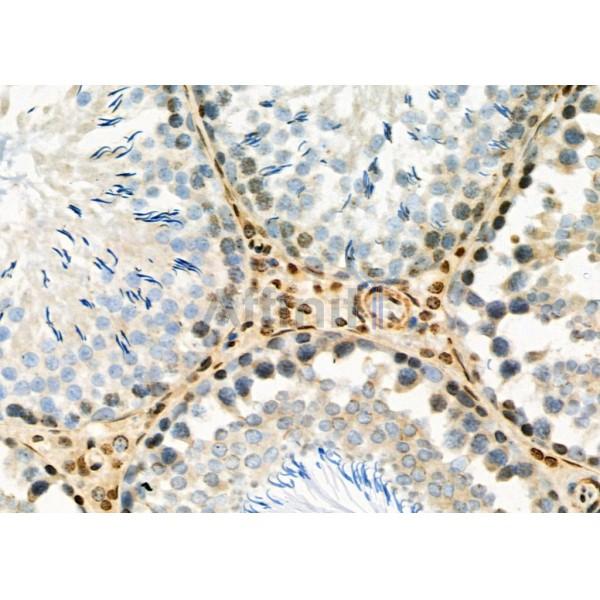 PSMB1 Antibody - DF6193 at 1/100 staining Mouse skin tissue by IHC-P.