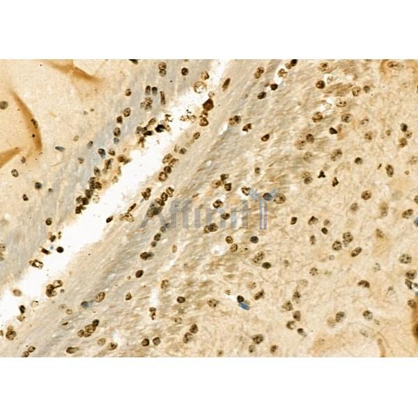 TAP2 Antibody - DF6498 at 1/100 staining Mouse brain tissue by IHC-P.