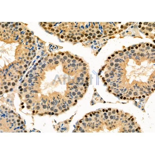 TAP2 Antibody - DF6498 at 1/100 staining Mouse testis tissue by IHC-P.