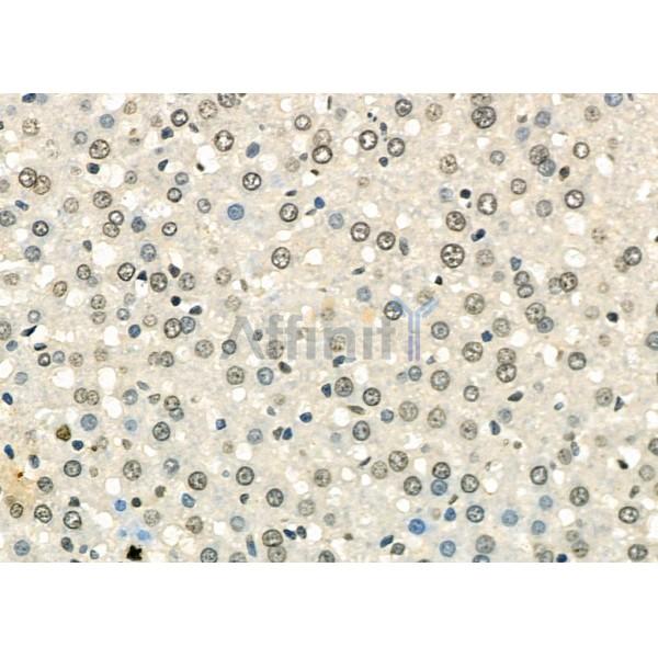 TAP2 Antibody - DF6498 at 1/100 staining Rat liver tissue by IHC-P.