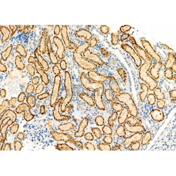 SLC25A4 Antibody - DF6674 at 1/100 staining Rat kidney tissue by IHC-P.