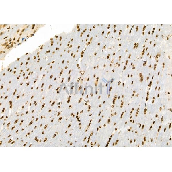 ILF3 Antibody - DF6965 at 1/100 staining Mouse brain tissue by IHC-P.