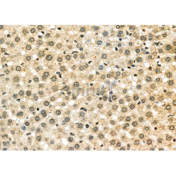 ILF3 Antibody - DF6965 at 1/100 staining Rat liver tissue by IHC-P.