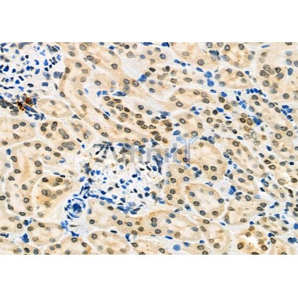 ILF3 Antibody - DF6965 at 1/100 staining Rat kidney tissue by IHC-P.