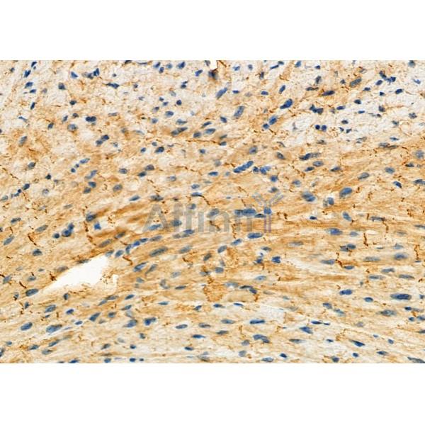 TRAP1 Antibody - DF7073 at 1/100 staining Mouse heart tissue by IHC-P.