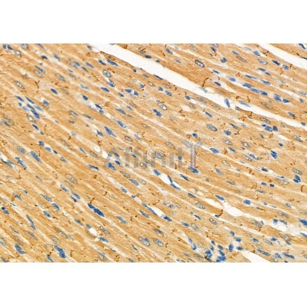TRAP1 Antibody - DF7073 at 1/100 staining Rat heart tissue by IHC-P.