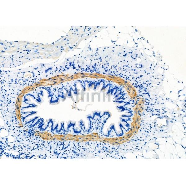 Calponin Antibody - DF7671 at 1/100 staining Rat lung tissue by IHC-P.