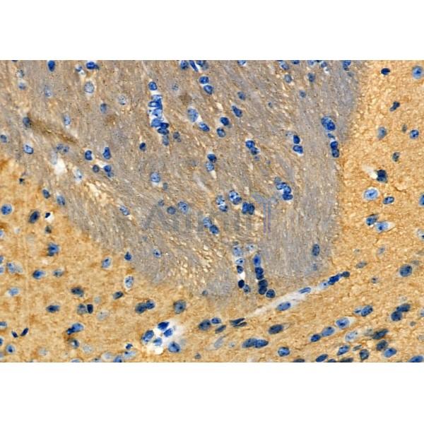 SOD3 Antibody - DF7753 at 1/100 staining Mouse brain tissue by IHC-P.