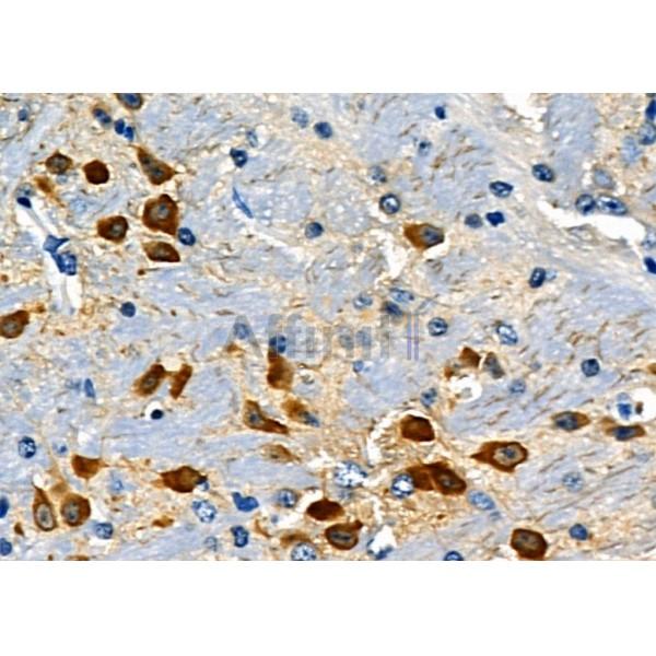OLIG2 Antibody - DF8004 at 1/100 staining Mouse brain tissue by IHC-P.