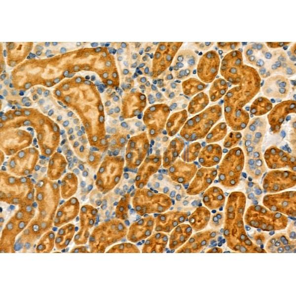 LY6A Antibody - DF8052 at 1/100 staining Mouse kidney tissue by IHC-P.