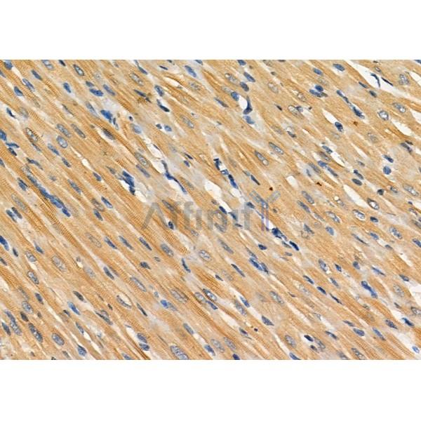 Inhibin beta C chain Antibody - DF8568 at 1/100 staining Rat heart tissue by IHC-P.