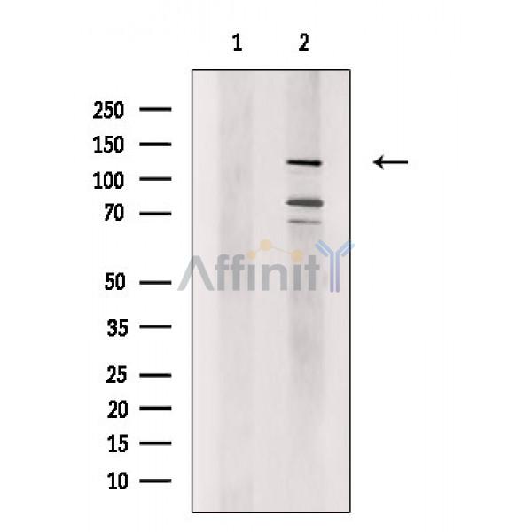 FOG2 Antibody - Western blot analysis of extracts from HepG2 cells, using FOG2 Antibody.