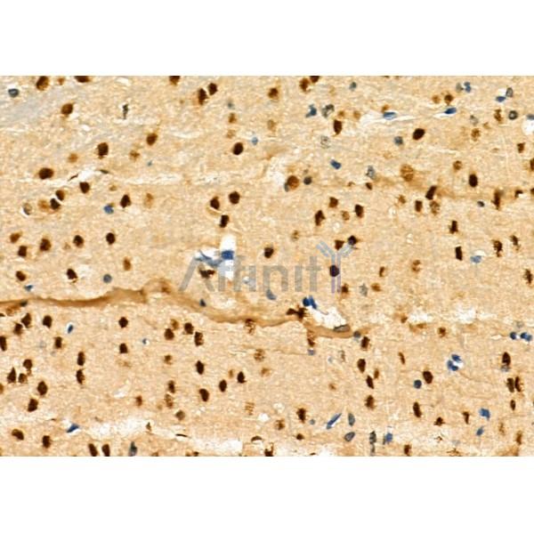 RNF6 Antibody - DF8890 at 1/100 staining Mouse brain tissue by IHC-P.