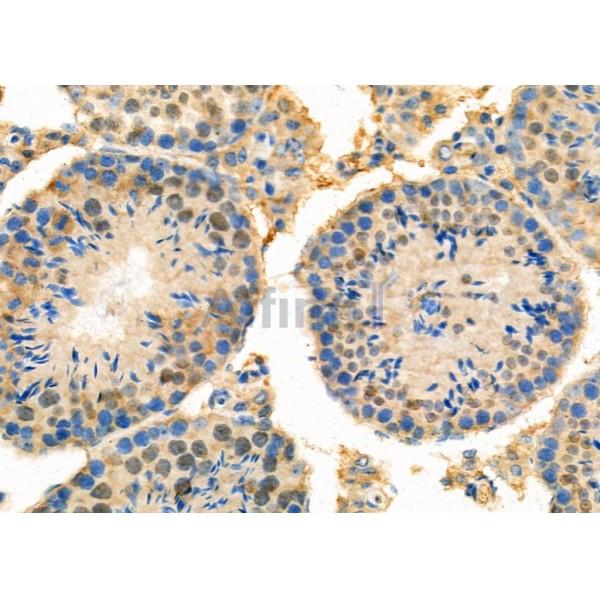 RNF6 Antibody - DF8890 at 1/100 staining Mouse testis tissue by IHC-P.
