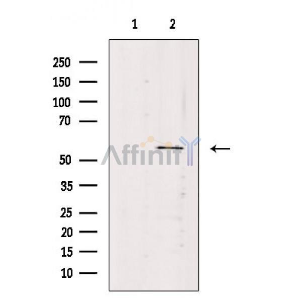 VEZF1 Antibody - Western blot analysis of extracts from Rat spleen, using VEZF1 Antibody.