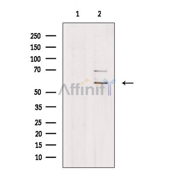 ACVR2B Antibody - Western blot analysis of extracts from COLO205 cells, using ACVR2B Antibody.