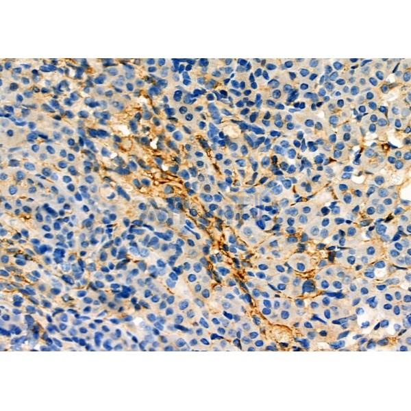 AQP11 Antibody - DF9222 at 1/100 staining Mouse kidney tissue by IHC-P.