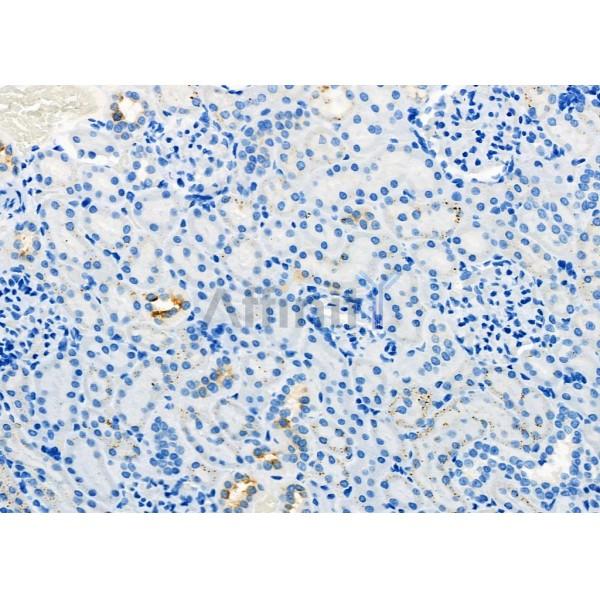 AQP11 Antibody - DF9222 at 1/100 staining Rat kidney tissue by IHC-P.