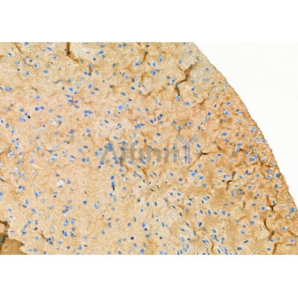 KCNJ10 Antibody - DF9260 at 1/100 staining Mouse brain tissue by IHC-P.