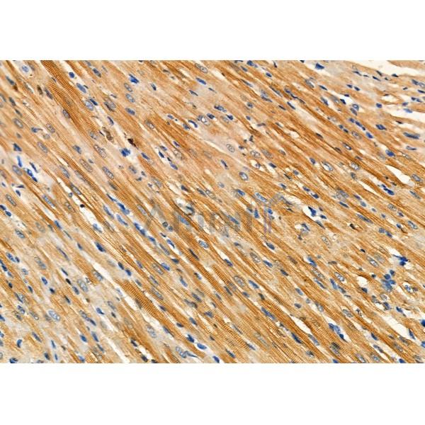 BMP1 Antibody - DF9280 at 1/100 staining Rat heart tissue by IHC-P.