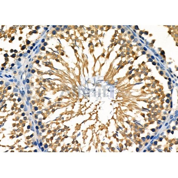 BMP1 Antibody - DF9280 at 1/100 staining Rat testis tissue by IHC-P.