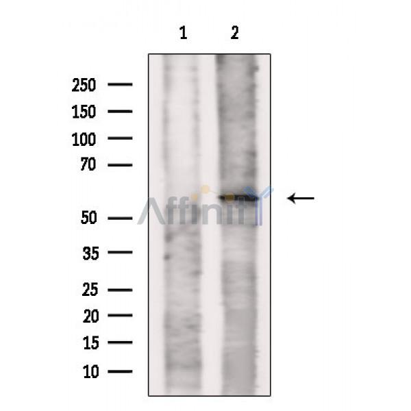 SLC22A17 Antibody - Western blot analysis of extracts from Rat spleen, using SLC22A17 Antibody.