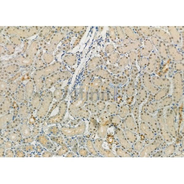 DYNLT3 Antibody - DF9474 at 1/100 staining Rat kidney tissue by IHC-P.