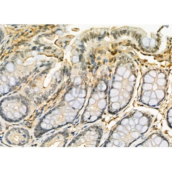 DYNLT3 Antibody - DF9474 at 1/100 staining Rat colorectal tissue by IHC-P.