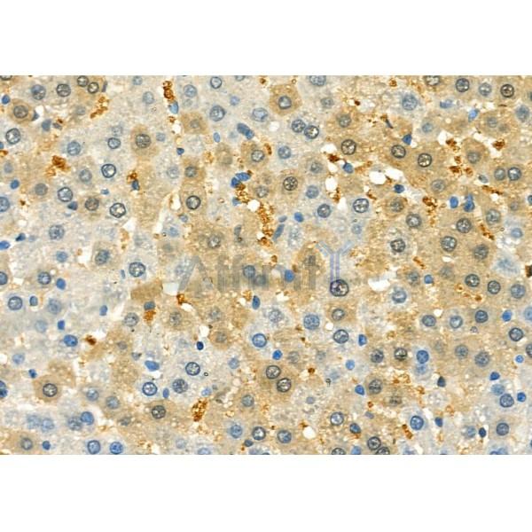 DFNA5/GSDME Antibody - DF9705 at 1/100 staining Rat liver tissue by IHC-P.